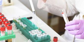 Scientist pipeting into small test tubes